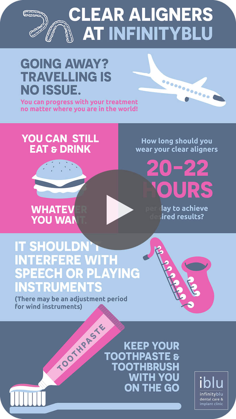 Clear Aligners animated infograph
