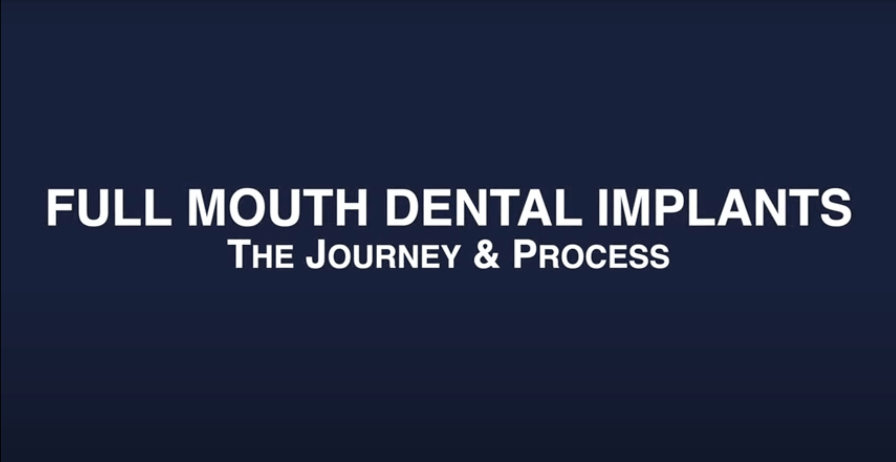 FAQ - Full mouth journey & Process