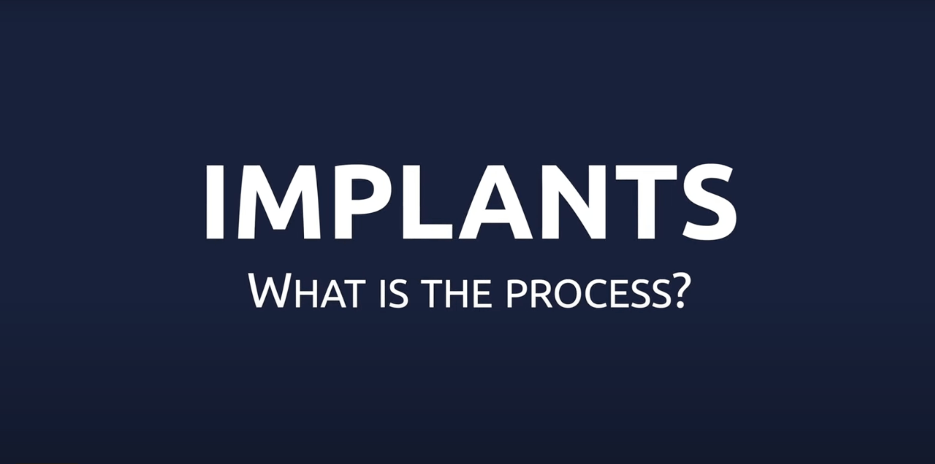 FAQ - What is the process?